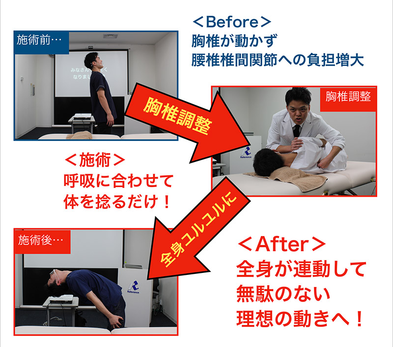 施術Before/After