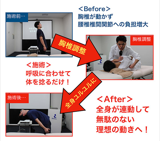 施術Before/After