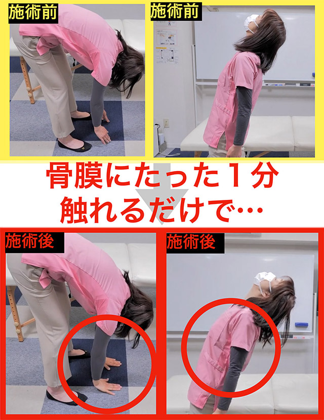 骨膜にたった1分触れるだけで…