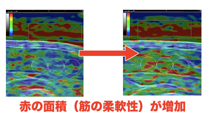 臨床研究による証明