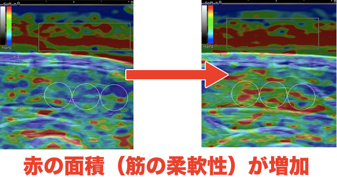 赤の面積（筋の柔軟性）が増加